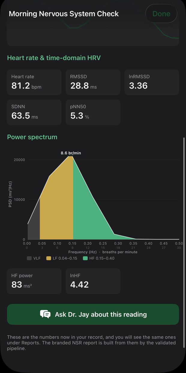 Reading results showing heart rate, RMSSD, SDNN and the power spectrum chart